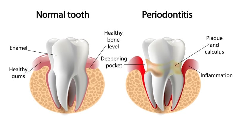 Periodontics